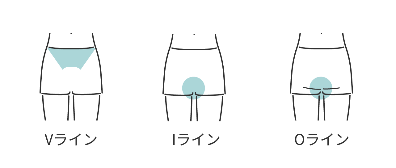 レディースVIOカテゴリー