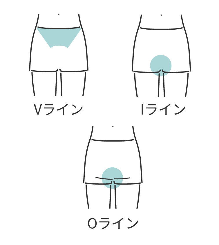 レディースVIOカテゴリー